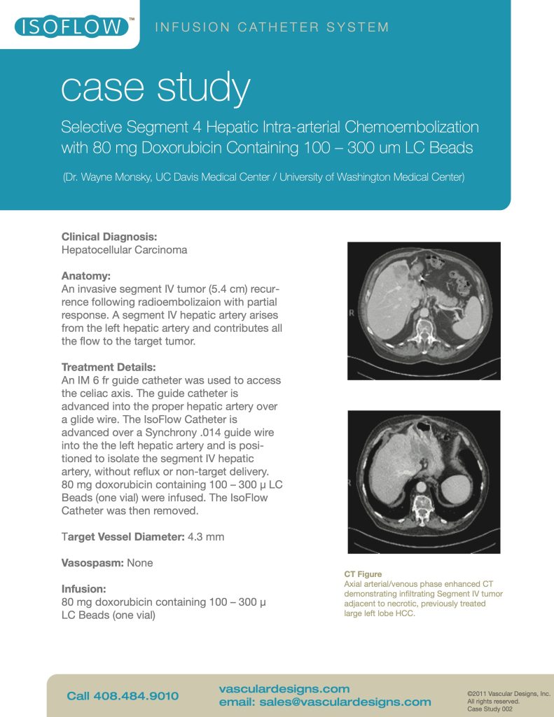 Vascular designs case study